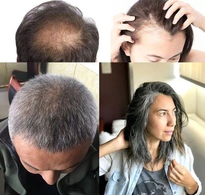 洗頭水中撒一把，頭發長得又快又茂密，白發都沒了！